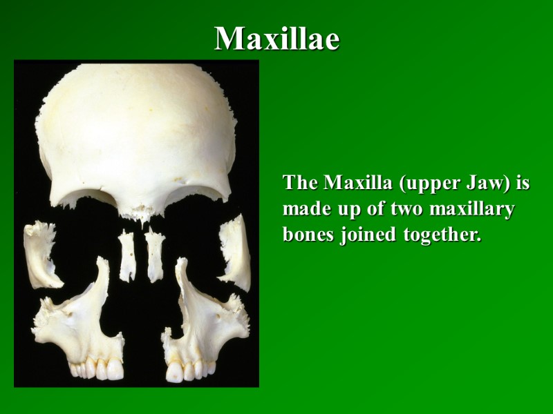 Maxillae   The Maxilla (upper Jaw) is made up of two maxillary bones
